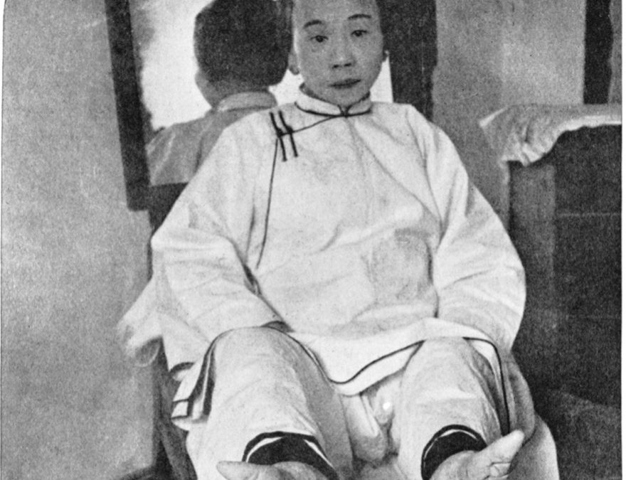 Trouver chaussure à son pied