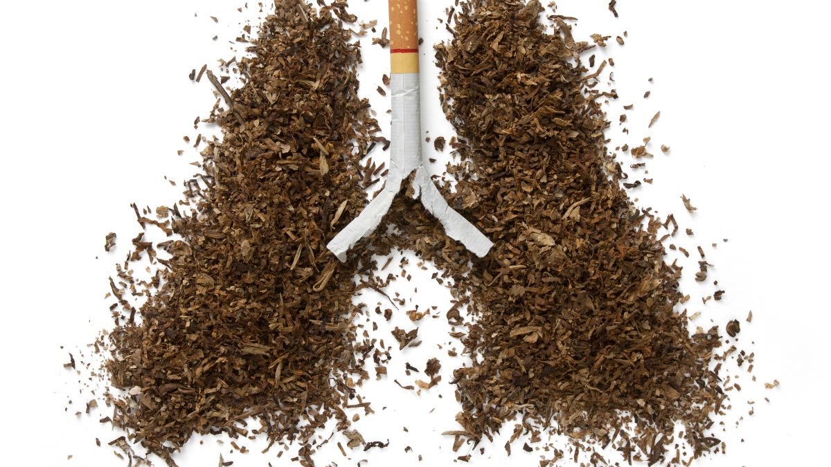 Le tabagisme diminue. Le cancer du poumon progresse. Pourquoi ?